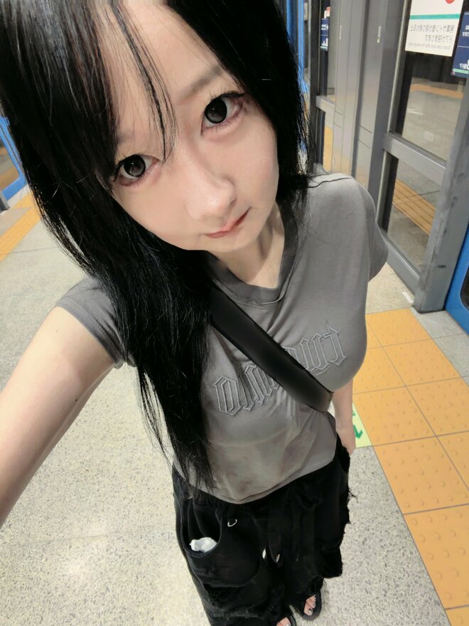 「私はこれからも整形が大好き」『夜ふかし』多田さん、“顎骨を切る大手術”から3か月のビフォーアフター写真に反響の画像