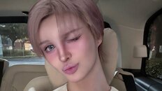 「顎が3cm伸びた」整形総額4桁万円のMatt、ヒアルロン酸で“顔面変化”を激白　父・桑田真澄に憧れるも断念