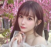 「整形は努力じゃないとかいわないで」整形総額2000万円超えモデル、激変ビフォアフ＆壮絶ダウンタイム公開でアンチに言及