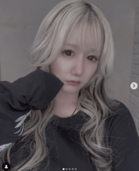 「“痩せること”が一番の整形」日テレ『月曜から夜ふかし』“フェフ姉さんの相方”多田さん、痛々しいアザが残る脂肪吸引後の姿をインスタストーリーズで公開