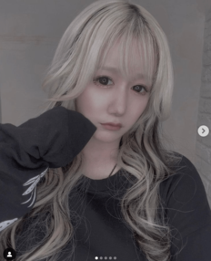 「“痩せること”が一番の整形」日テレ『月曜から夜ふかし』“フェフ姉さんの相方”多田さん、痛々しいアザが残る脂肪吸引後の姿をインスタストーリーズで公開