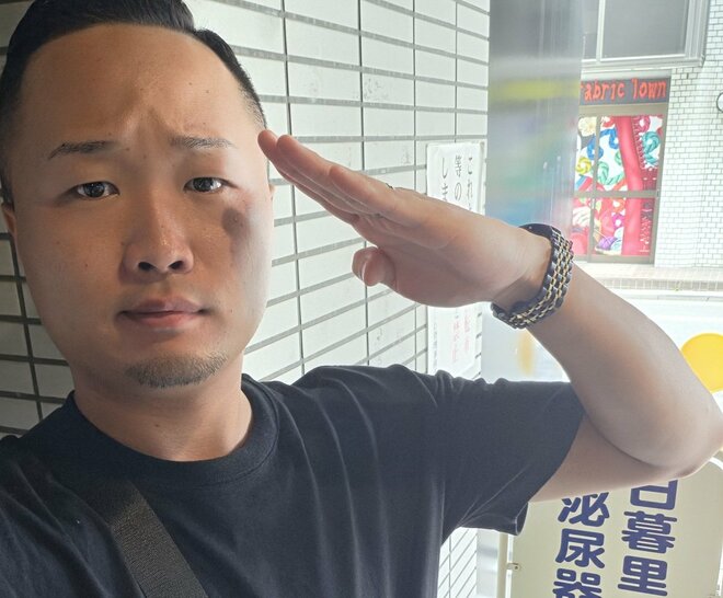 パイプカット報告で騒然の27歳芸人・GO!GO!HAYATOを直撃 「提案は妻から」語った手術の理由とリアルすぎる“体験談”の画像