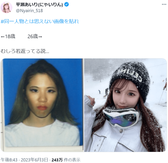 「馬面ブス」といわれ続けた“整形総額2000万円超え”インフルエンサー平瀬あいり、フル整形前の超別人成人式ショット公開！の画像