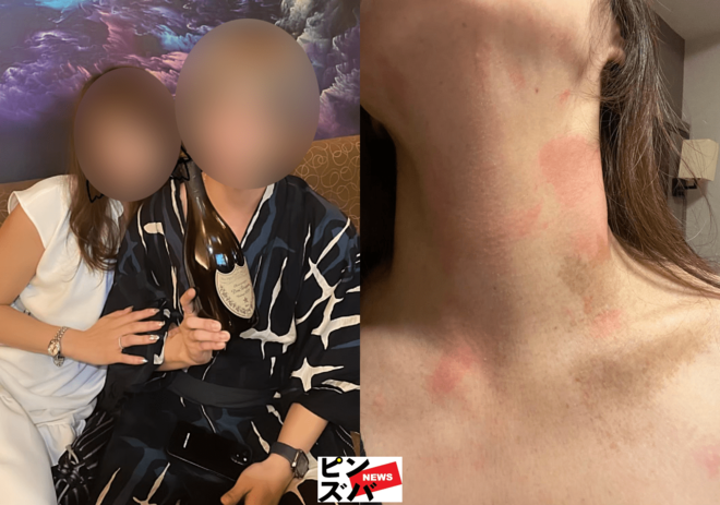 『令和の虎』がオーナーのホスト店で3度の暴力沙汰 被害女性が告白「対応途中で音信普通に……」の画像