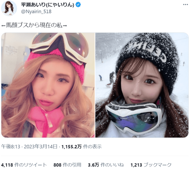 「好きだった男の子にブスと晒されて…」整形総額1000万の人気インフルエンサー平瀬あいり“ほぼ全顔整形”した顔面ビフォーアフターの画像