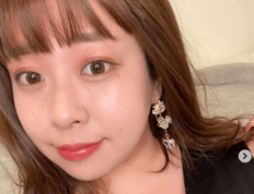 「じーんとする動画でした」餅田コシヒカリ“ウィッグの真相”は「脱毛症」 勇気ある告白に称賛「動画に救われました」「素敵な人だ」