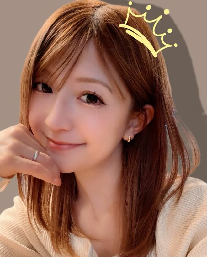 「20代にしか見えない」矢口真里、美容医療姿が話題も…芸人からは「違法エフェクト」イジられの一流バラドル感の画像