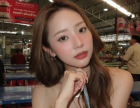 「おでこにコブが2個できた」中町綾、2年前におでこに入れたヒアルロン酸に“問題多発”で全溶かしへ