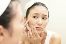 寒暖差、花粉、紫外線…春は肌荒れの季節！専門医が「過剰な手入れはNG」と語る理由