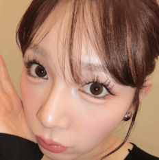 「顔見てビックリ」古川優香、“目周り黄色”のクマ取り整形ダウンタイム姿に驚きの声「顔が全然違う」