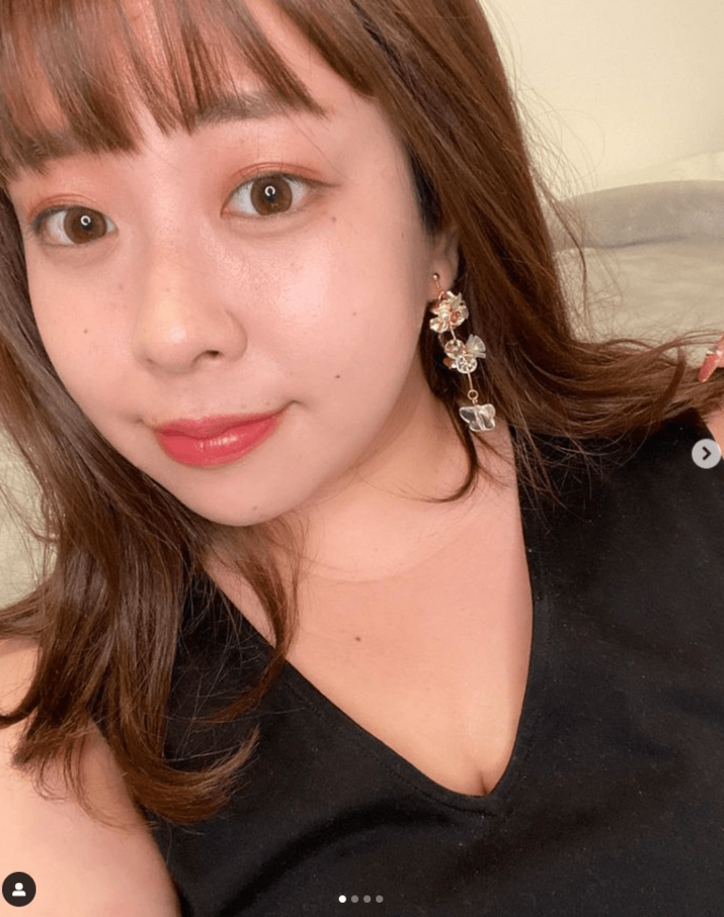 「じーんとする動画でした」餅田コシヒカリ“ウィッグの真相”は「脱毛症」 勇気ある告白に称賛「動画に救われました」「素敵な人だ」の画像