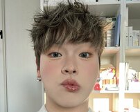 「加藤諒に見えた」SNS総フォロワー150万超え美容男子インフルエンサー、整形ダウンタイムで唇が超肥大