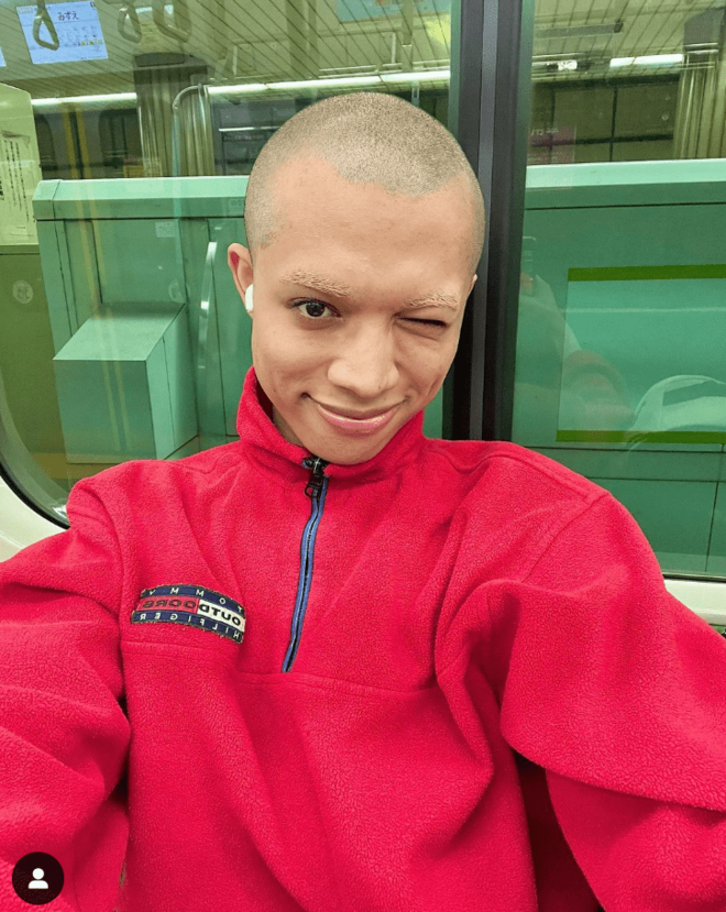 「3秒でとった」TikTokフォロワー100万人超えのロイ、顔のほくろを除去した理由が想定外！の画像