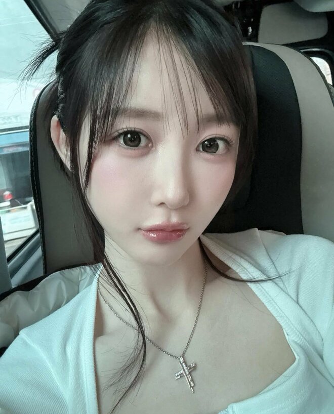 「面影が全くない」整形公表の人気YouTuberの“激変”近影にネット動揺…1年前には目頭切開の修正手術を報告の画像