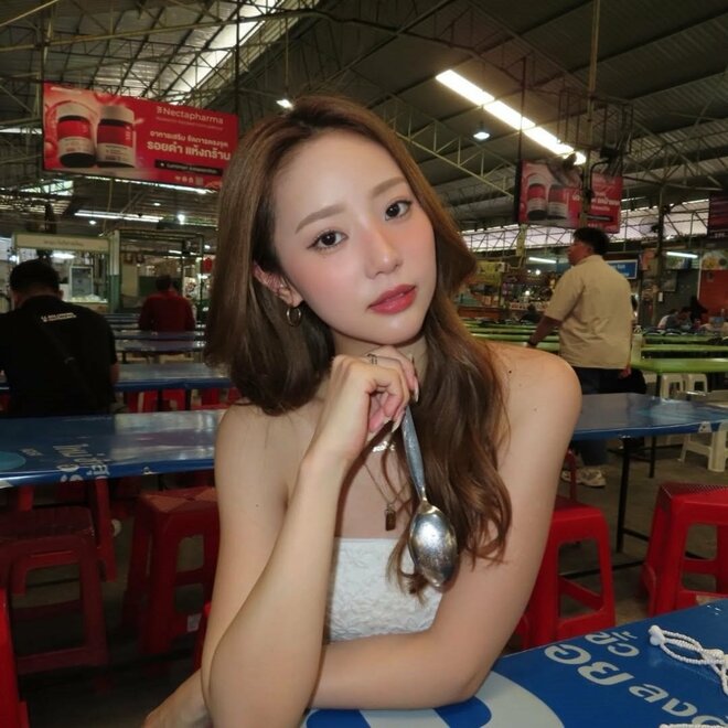 「おでこにコブが2個できた」中町綾、2年前におでこに入れたヒアルロン酸に“問題多発”で全溶かしへの画像