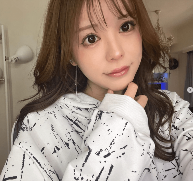 「鼻以外全部整形」元男性美容系YouTuberちゅる「やらなきゃよかった手術」明かすの画像