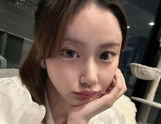 「目が閉じれず涙ちょちょぎれ」‟伝説のモテ美女”小澤美里、過去最多本数糸リフトを報告 “バストトップ”の施術も明かす