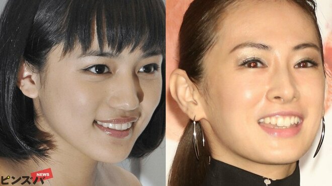 川口春奈はがん患者役で「どこに10kgも落とすところが…」、北川景子は「一年以上やつれ」トップ女優2人の壮絶減量の画像