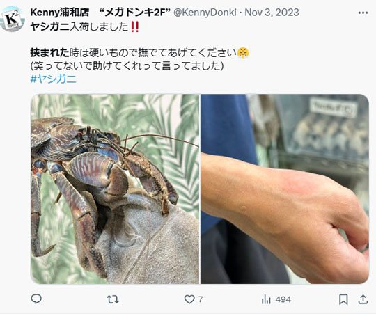最強のカニ“ヤシガニ”と、ヤシガニに手を挟まれ腫れた手を見せる男性。（画像はXアカウント@KennyDonkiより）