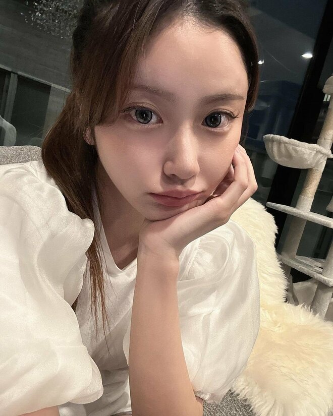 「目が閉じれず涙ちょちょぎれ」‟伝説のモテ美女”小澤美里、過去最多本数糸リフトを報告 “バストトップ”の施術も明かすの画像