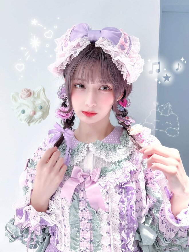 「上唇ちゃんと動くんだよね？」“顎変形症”告白のしなこ、骨切り後の顔面異変に心配の声…7時間の大手術から2週間の画像