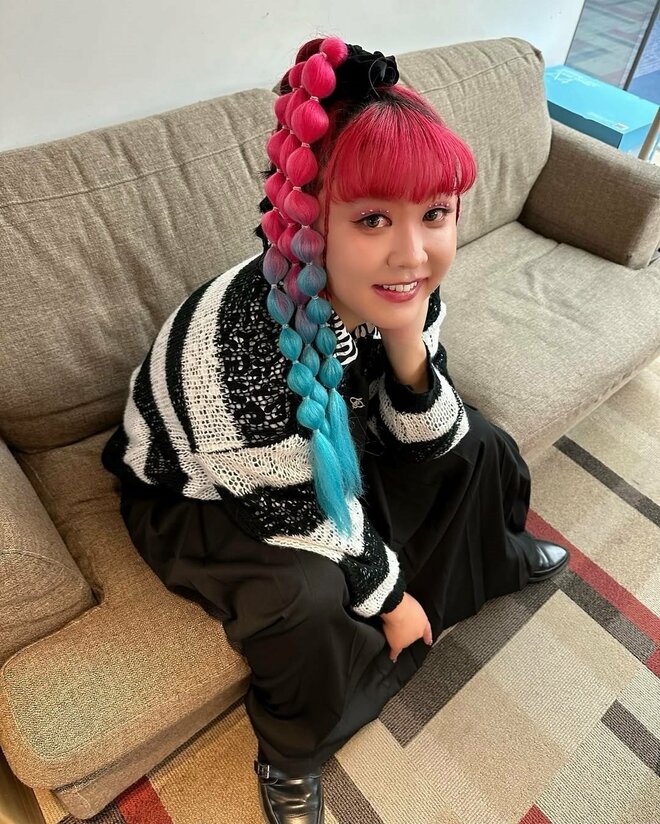 「目がパッチリ！」「表情パキッと」登録者数90万人超大人気Youtuber、“目の手術”で「すごい違和感」告白の画像